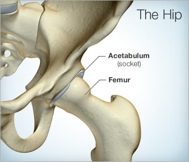 Painful Hip